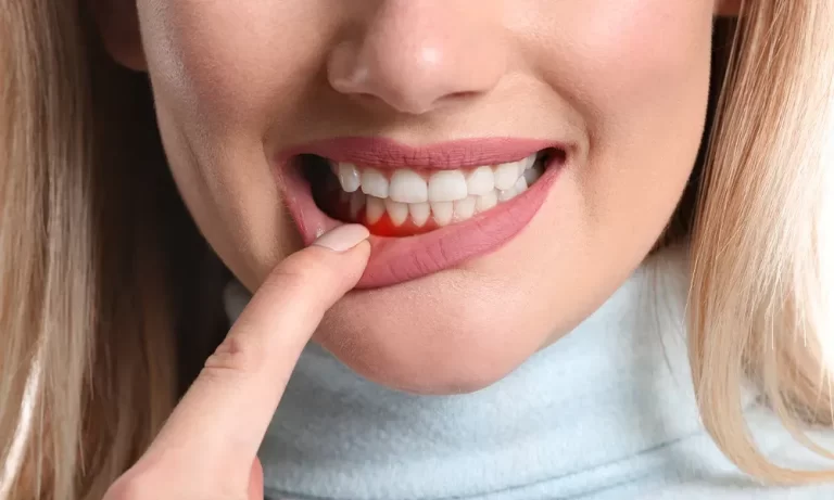 Periodontal Disease: An In-Depth Look at Gum Health and Treatments